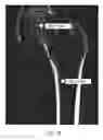 Fig. 15 - Personalized assessment of bone health
