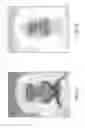 Fig. 05 - Simplified gate stack process to improve dual channel CMOS performance