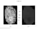 Fig. 11 - Method and device for recognizing fingerprint