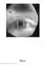 Fig. 03 - Determining eye openness with an eye tracking device