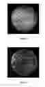 Fig. 05 - HIGH RESOLUTION MICROENDOSCOPE EMPLOYING DIFFERENTIAL STRUCTURED ILLUMINATION AND METHOD OF USING SAME