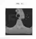 Fig. 09 - Method and apparatus for segmenting medical images