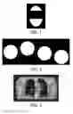 Fig. 02 - Respiratory motion compensation for four-dimensional computed tomography imaging using ultrasound
