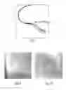 Fig. 07 - Enhanced imaging of a vascular treatment
