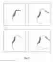 Fig. 08 - Enhanced imaging of a vascular treatment