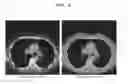 Fig. 06 - METHOD AND APPARATUS FOR CONTROLLING 3D MEDICAL IMAGE