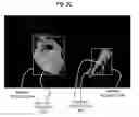 Fig. 04 - Automated surgeon performance evaluation