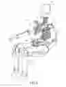 Fig. 03 - Head assembly with facial insert for crash test dummy