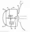 Fig. 01 - Noise cancellation system with lower rate emulation