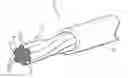Fig. 01 - Electrically conductive carbon nanotube wire having a metallic coating and methods of forming same