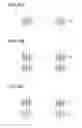 Fig. 17 - Solid-state imaging device, method for manufacturing solid-state imaging device, and electronic apparatus
