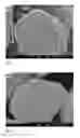 Fig. 02 - ANODE MATERIALS FOR LITHIUM BATTERY OF IMPROVED TEMPERATURE PERFORMANCE