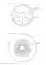 Fig. 04 - Magnetic Gear Device