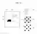 Fig. 13 - Image processing apparatus, image processing method, and recording medium to correct characteristic amount of target pixel using brightness at two pixels in set target area