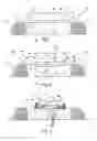 Fig. 02 - Headphone