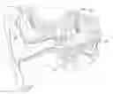 Fig. 01 - Fixation of a bone conduction floating mass transducer