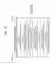 Fig. 13 - Method and apparatus for transmitting metadata in WFD