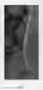 Fig. 08 - TX-10-G-L-11-9-12-5