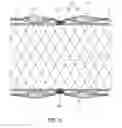 Fig. 09 - FISHING TOOL FLOATING ROPE