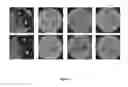 Fig. 02 - LACTOBACILLUS FERMENTUM BACTERIA WITH ANTIFUNGAL ACTIVITY