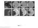 Fig. 03 - LACTOBACILLUS FERMENTUM BACTERIA WITH ANTIFUNGAL ACTIVITY