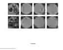 Fig. 04 - LACTOBACILLUS FERMENTUM BACTERIA WITH ANTIFUNGAL ACTIVITY