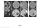 Fig. 05 - LACTOBACILLUS FERMENTUM BACTERIA WITH ANTIFUNGAL ACTIVITY