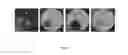 Fig. 08 - LACTOBACILLUS FERMENTUM BACTERIA WITH ANTIFUNGAL ACTIVITY