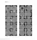 Fig. 17 - LACTOBACILLUS FERMENTUM BACTERIA WITH ANTIFUNGAL ACTIVITY