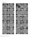 Fig. 20 - LACTOBACILLUS FERMENTUM BACTERIA WITH ANTIFUNGAL ACTIVITY