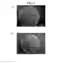 Fig. 07 - Powdery fat or oil composition and method for producing same