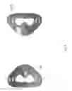 Fig. 06 - Protective foam mask