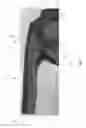 Fig. 09 - Article of Apparel