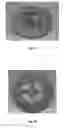Fig. 11 - Adapter for a single serve capsule