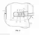Fig. 03 - Vacuum cleaner including a surface cleaning head having a display
