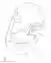 Fig. 06 - Endoscope head