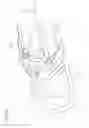 Fig. 15 - Endoscope head