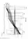 Fig. 116 - Fluid distribution device for a multiple viewing elements endoscope