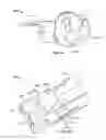 Fig. 14 - Fluid distribution device for a multiple viewing elements endoscope