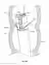 Fig. 167 - Fluid distribution device for a multiple viewing elements endoscope