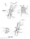 Fig. 03 - Blade insert illuminator