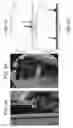 Fig. 03 - Blinking multiplexed LED strain and chemical sensors for implanted medical devices