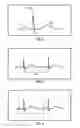 Fig. 03 - System and method for biometric ECG verification of patient identity