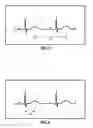 Fig. 04 - System and method for biometric ECG verification of patient identity