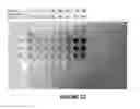 Fig. 14 - COLOROMETRIC SENSOR FOR THE NON-INVASIVE SCREENING OF GLUCOSE IN SWEAT IN PRE AND TYPE 2 DIABETES