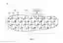 Fig. 03 - Smart textile to predict risk of diabetic foot ulcer