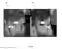 Fig. 09 - Smart textile to predict risk of diabetic foot ulcer