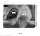 Fig. 11 - Smart textile to predict risk of diabetic foot ulcer
