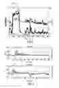 Fig. 03 - Device, system and method for estimating the energy expenditure of a person