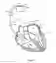 Fig. 02 - Cardiac response classification using retriggerable classification windows